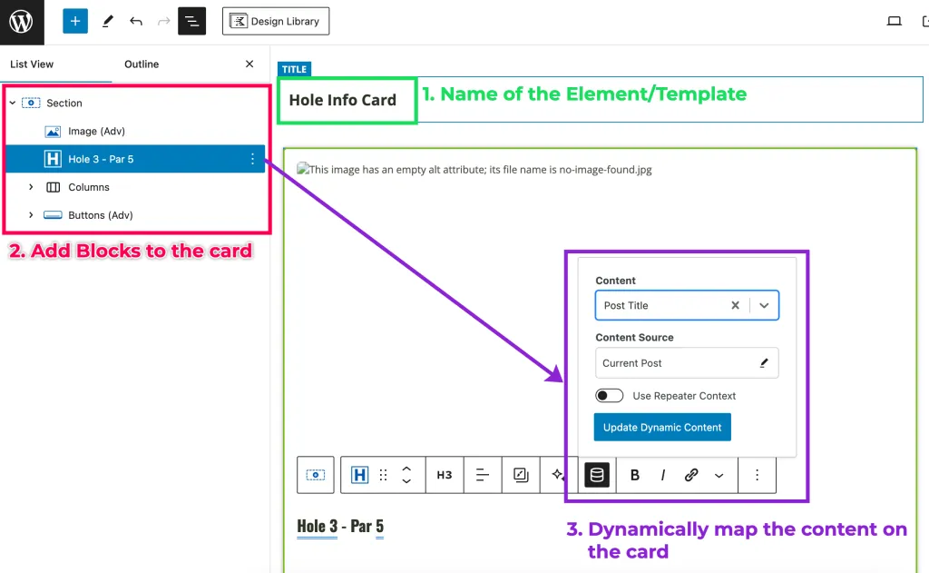 Creating an archive template loop Kadence Elements