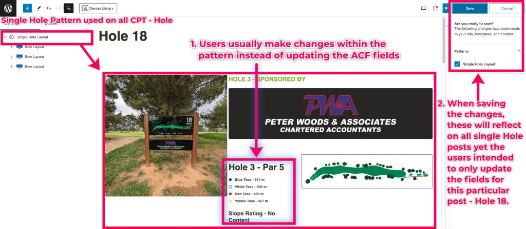 Users will usually update the CPT post content from within the block pattern instead of updating the ACF Fields