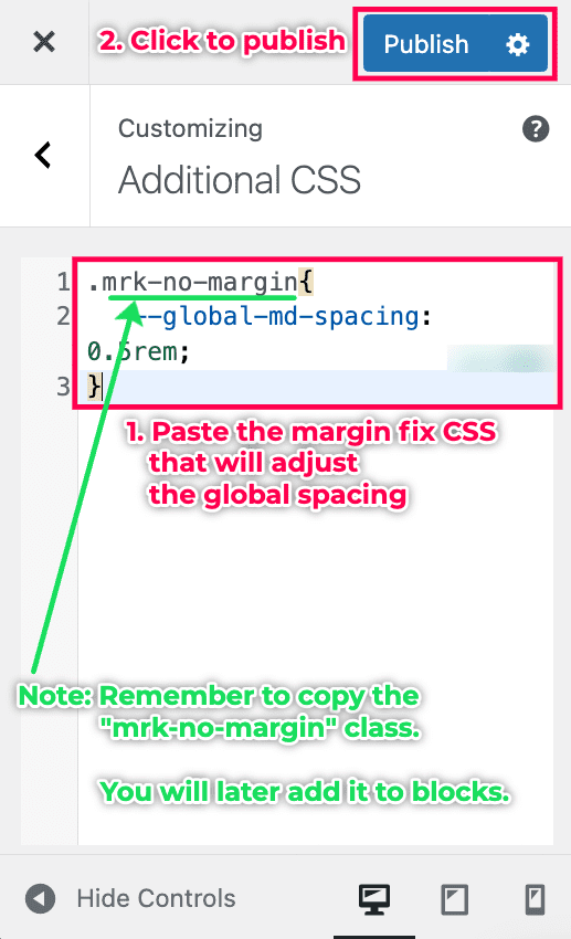 Adding the Margin CSS code snippet to Kadence Additional CSS